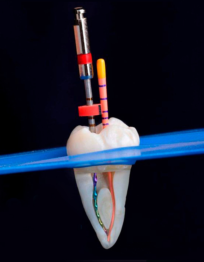 Implantología, Rehabilitación dental, Limpieza dental, Operatoria dental, Endodoncia mecanizada, Ortopedia y ortodoncia, Estética dental en Bahía Blanca - Consultorio odontológico privado