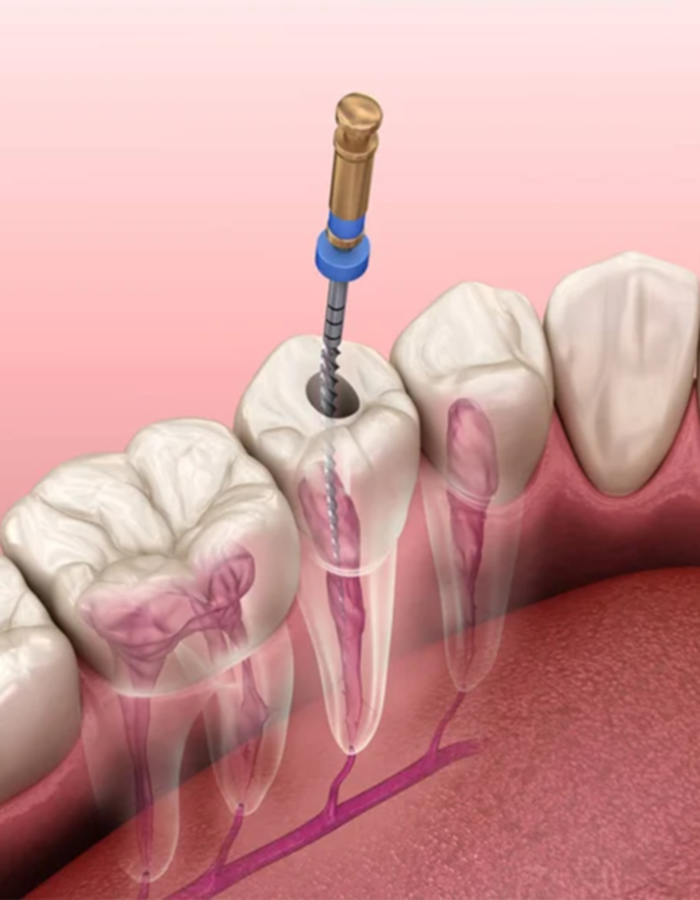 Implantología, Rehabilitación dental, Limpieza dental, Operatoria dental, Endodoncia mecanizada, Ortopedia y ortodoncia, Estética dental en Bahía Blanca - Consultorio odontológico privado