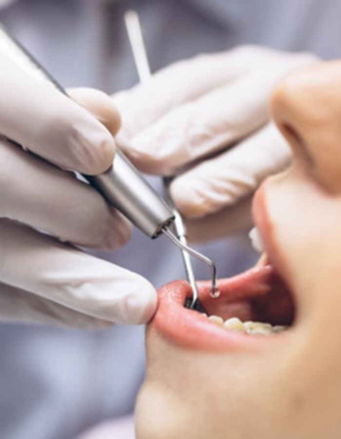 Implantología, Rehabilitación dental, Limpieza dental, Operatoria dental, Endodoncia mecanizada, Ortopedia y ortodoncia, Estética dental en Bahía Blanca - Consultorio odontológico privado
