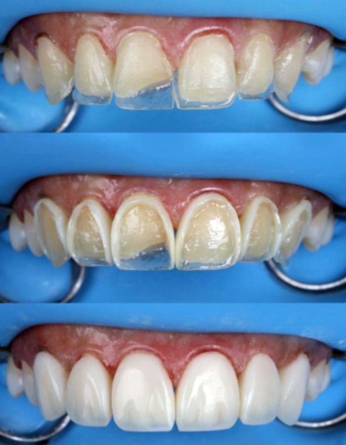 Implantología, Rehabilitación dental, Limpieza dental, Operatoria dental, Endodoncia mecanizada, Ortopedia y ortodoncia, Estética dental en Bahía Blanca - Consultorio odontológico privado