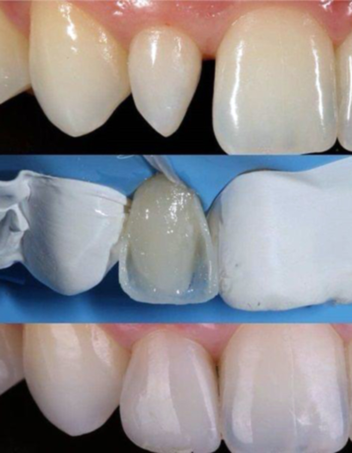Implantología, Rehabilitación dental, Limpieza dental, Operatoria dental, Endodoncia mecanizada, Ortopedia y ortodoncia, Estética dental en Bahía Blanca - Consultorio odontológico privado
