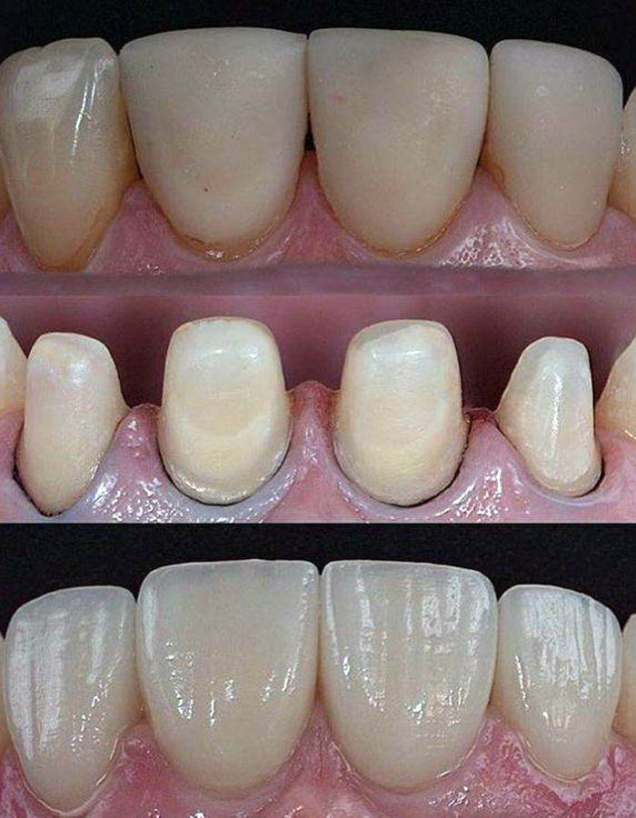Implantología, Rehabilitación dental, Limpieza dental, Operatoria dental, Endodoncia mecanizada, Ortopedia y ortodoncia, Estética dental en Bahía Blanca - Consultorio odontológico privado