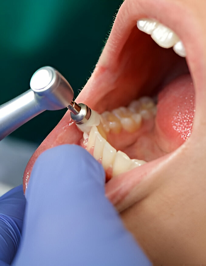 Implantología, Rehabilitación dental, Limpieza dental, Operatoria dental, Endodoncia mecanizada, Ortopedia y ortodoncia, Estética dental en Bahía Blanca - Consultorio odontológico privado