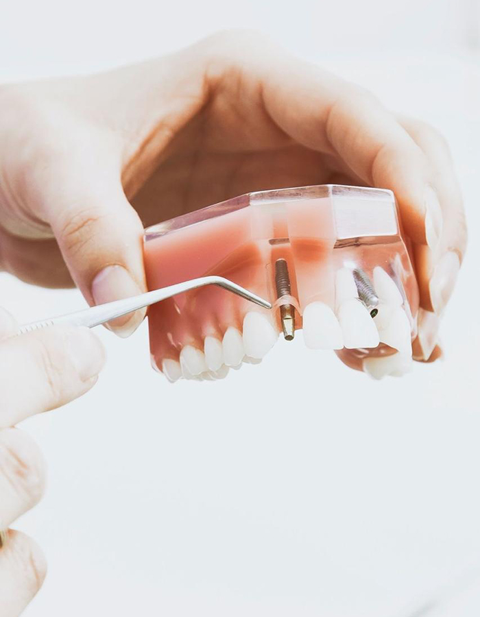 Implantología, Rehabilitación dental, Limpieza dental, Operatoria dental, Endodoncia mecanizada, Ortopedia y ortodoncia, Estética dental en Bahía Blanca - Consultorio odontológico privado