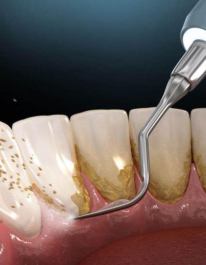 Implantología, Rehabilitación dental, Limpieza dental, Operatoria dental, Endodoncia mecanizada, Ortopedia y ortodoncia, Estética dental en Bahía Blanca - Consultorio odontológico privado