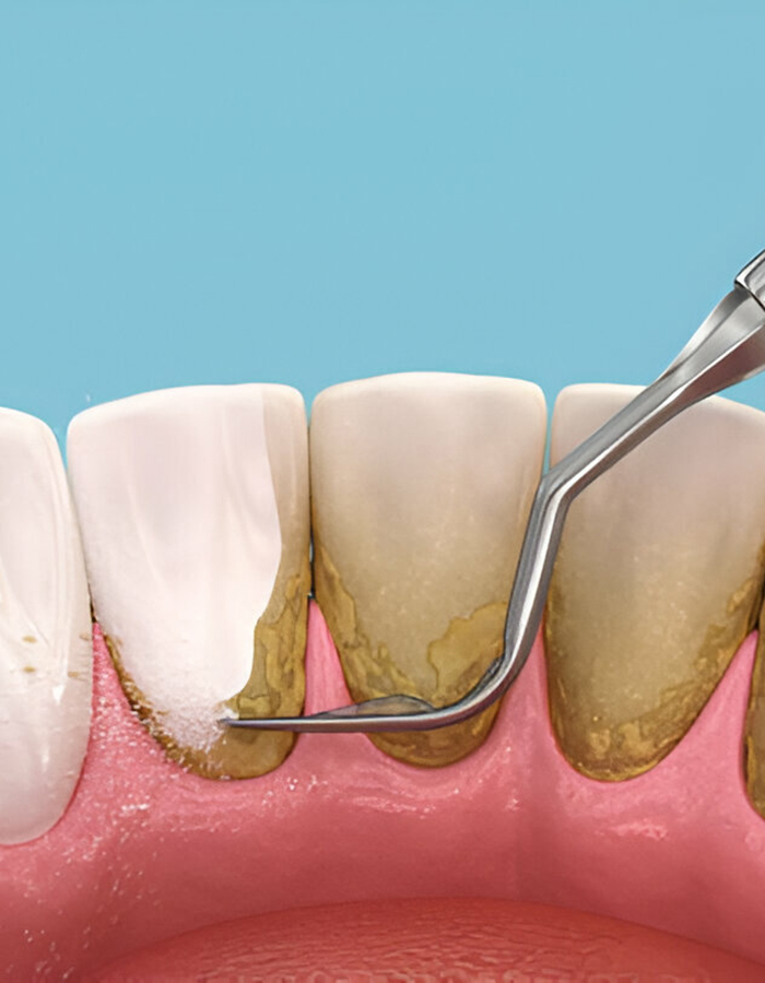Implantología, Rehabilitación dental, Limpieza dental, Operatoria dental, Endodoncia mecanizada, Ortopedia y ortodoncia, Estética dental en Bahía Blanca - Consultorio odontológico privado