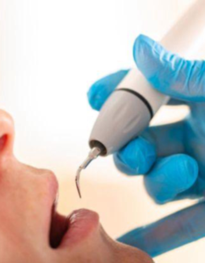 Implantología, Rehabilitación dental, Limpieza dental, Operatoria dental, Endodoncia mecanizada, Ortopedia y ortodoncia, Estética dental en Bahía Blanca - Consultorio odontológico privado