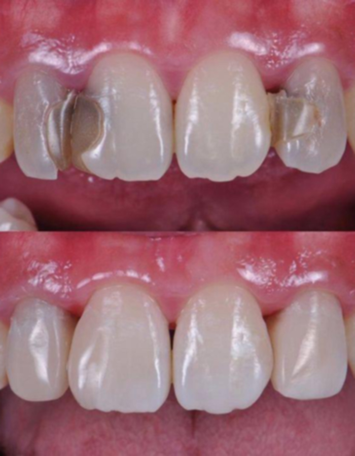Implantología, Rehabilitación dental, Limpieza dental, Operatoria dental, Endodoncia mecanizada, Ortopedia y ortodoncia, Estética dental en Bahía Blanca - Consultorio odontológico privado