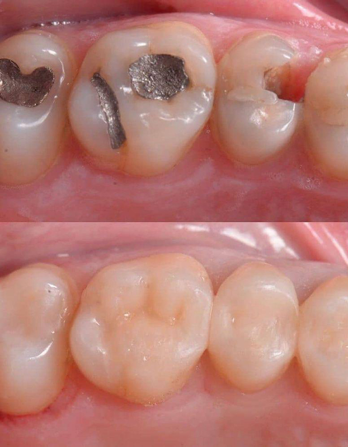 Implantología, Rehabilitación dental, Limpieza dental, Operatoria dental, Endodoncia mecanizada, Ortopedia y ortodoncia, Estética dental en Bahía Blanca - Consultorio odontológico privado
