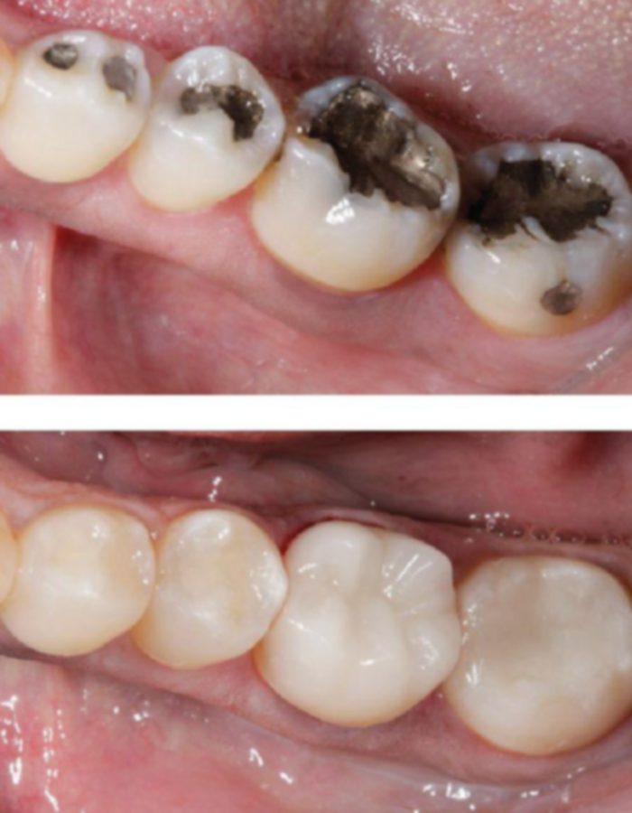 Implantología, Rehabilitación dental, Limpieza dental, Operatoria dental, Endodoncia mecanizada, Ortopedia y ortodoncia, Estética dental en Bahía Blanca - Consultorio odontológico privado