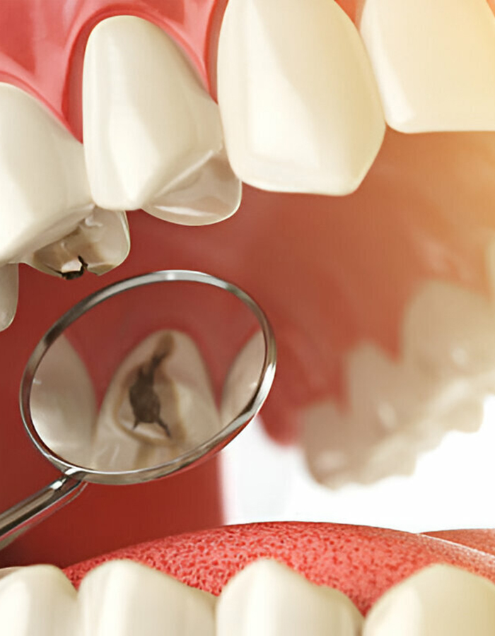 Implantología, Rehabilitación dental, Limpieza dental, Operatoria dental, Endodoncia mecanizada, Ortopedia y ortodoncia, Estética dental en Bahía Blanca - Consultorio odontológico privado