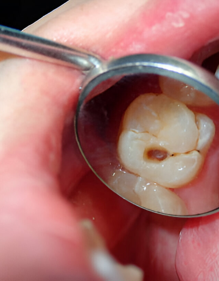 Implantología, Rehabilitación dental, Limpieza dental, Operatoria dental, Endodoncia mecanizada, Ortopedia y ortodoncia, Estética dental en Bahía Blanca - Consultorio odontológico privado