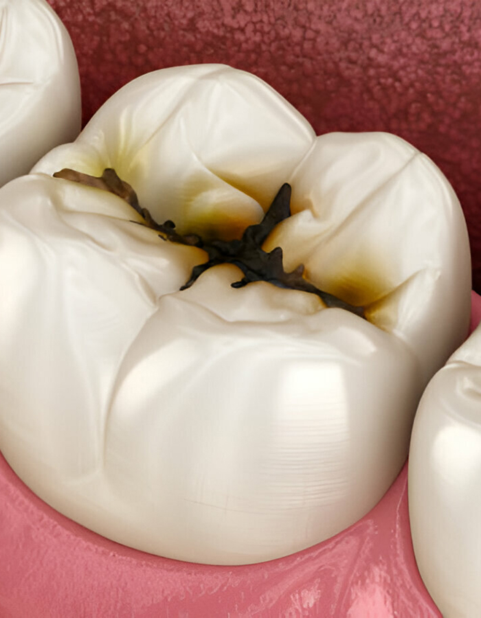 Implantología, Rehabilitación dental, Limpieza dental, Operatoria dental, Endodoncia mecanizada, Ortopedia y ortodoncia, Estética dental en Bahía Blanca - Consultorio odontológico privado