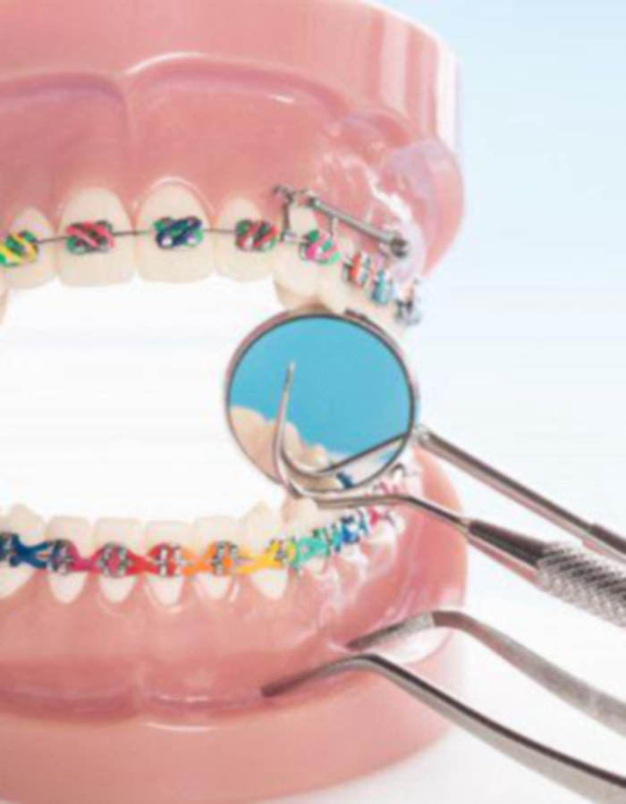 Implantología, Rehabilitación dental, Limpieza dental, Operatoria dental, Endodoncia mecanizada, Ortopedia y ortodoncia, Estética dental en Bahía Blanca - Consultorio odontológico privado