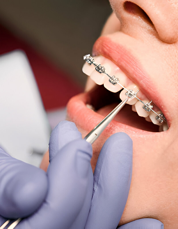 Implantología, Rehabilitación dental, Limpieza dental, Operatoria dental, Endodoncia mecanizada, Ortopedia y ortodoncia, Estética dental en Bahía Blanca - Consultorio odontológico privado
