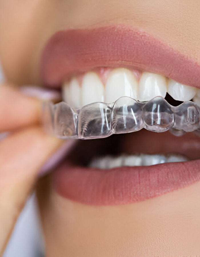 Implantología, Rehabilitación dental, Limpieza dental, Operatoria dental, Endodoncia mecanizada, Ortopedia y ortodoncia, Estética dental en Bahía Blanca - Consultorio odontológico privado