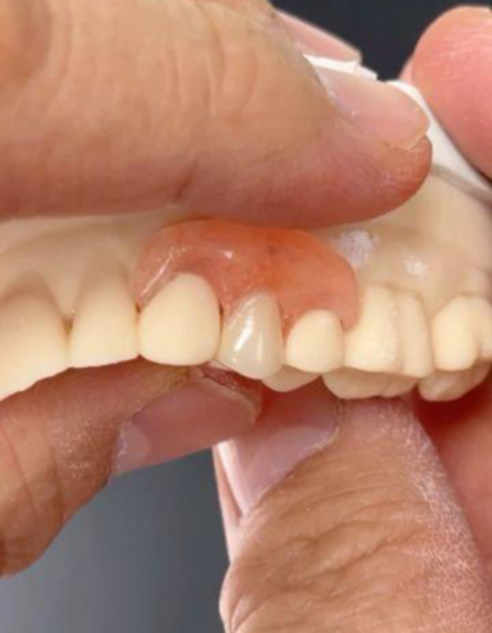 Implantología, Rehabilitación dental, Limpieza dental, Operatoria dental, Endodoncia mecanizada, Ortopedia y ortodoncia, Estética dental en Bahía Blanca - Consultorio odontológico privado